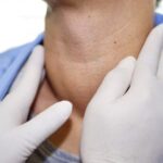 Thyroide