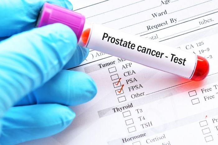 Taux de PSA : comprendre ce chiffre clé de la prostate
